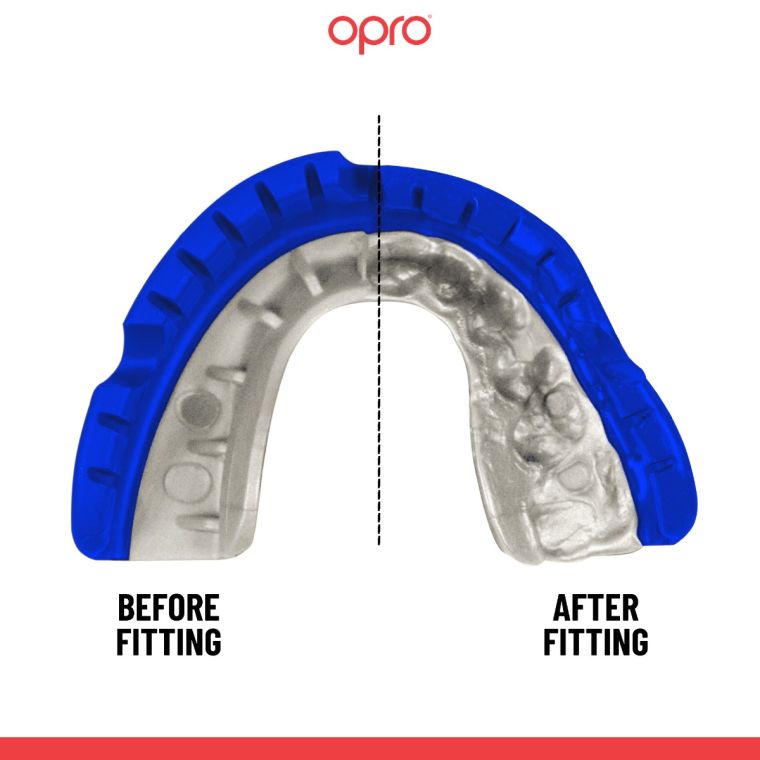 Mouth guard OPRO GEN5 Gold Braces Dark Blue Pearl price