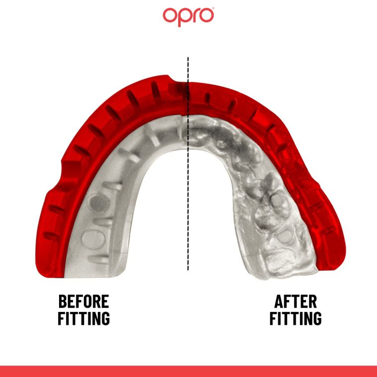 Mouthguard OPRO GEN5 Gold Braces Red Pearl price