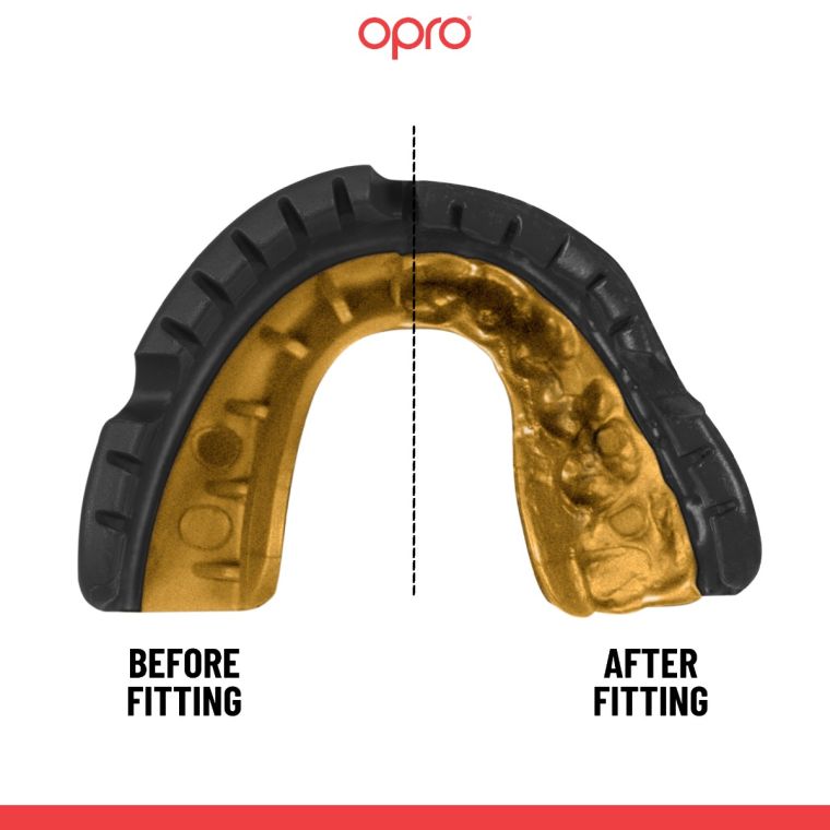 Mouth guard OPRO GEN5 Gold Braces Black Gold price