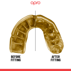 Капа OPRO Self-fit UFC GEN2 Gold Level Black Gold купити