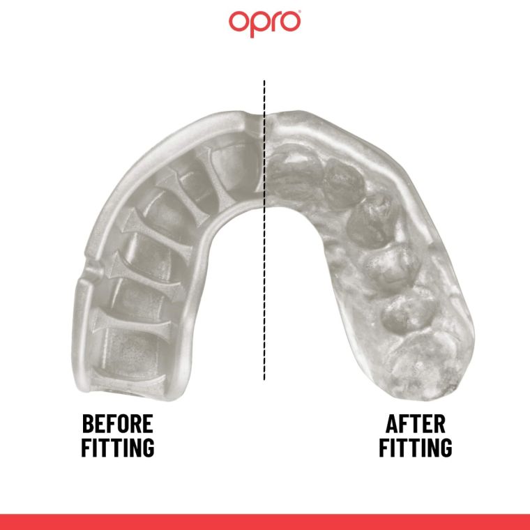 OPRO Self-Fit GEN5 Gold Level Red Pearl mouthguard price